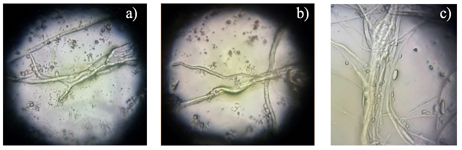 Killer Plants México - Sabías que El musgo Sphagnum es absorbente y de  un pH ácido de manera que previene el crecimiento de bacterias y hongos.  Durante la primera guerra mundial (1924-1918)