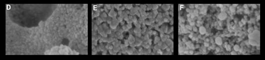 2007-0934-remexca-16-esp30-e4040-gf4.jpg